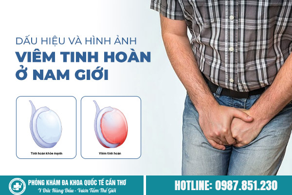 dấu hiệu viêm tinh hoàn